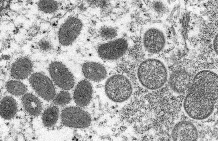 MS tem 10 pacientes com casos ativos de varíola dos macacos