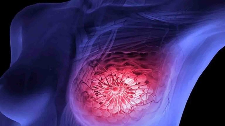 remedio-cancer-mama-768x432