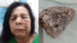 Idosa-pedrada-em-carro